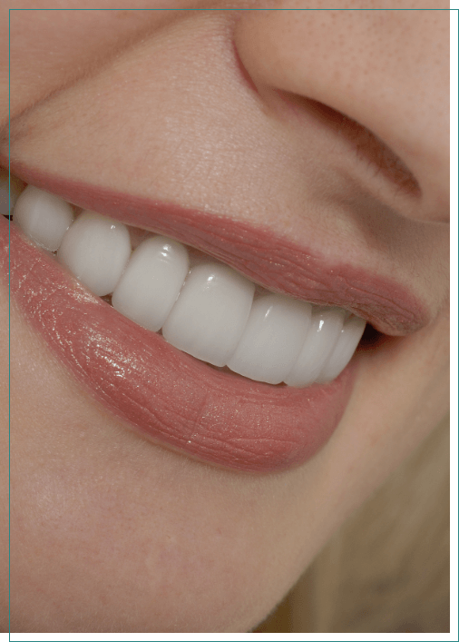 Close up of woman smiling with straight white teeth