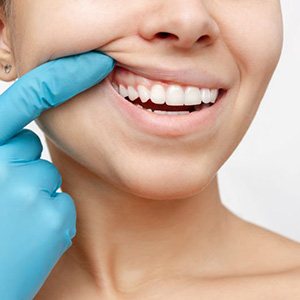 Woman pulling back her lip to show healthy gums