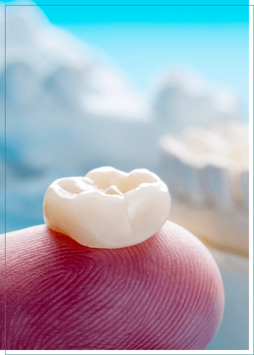 Dental crown resting on a finger