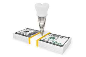Dental implant on a pile of money