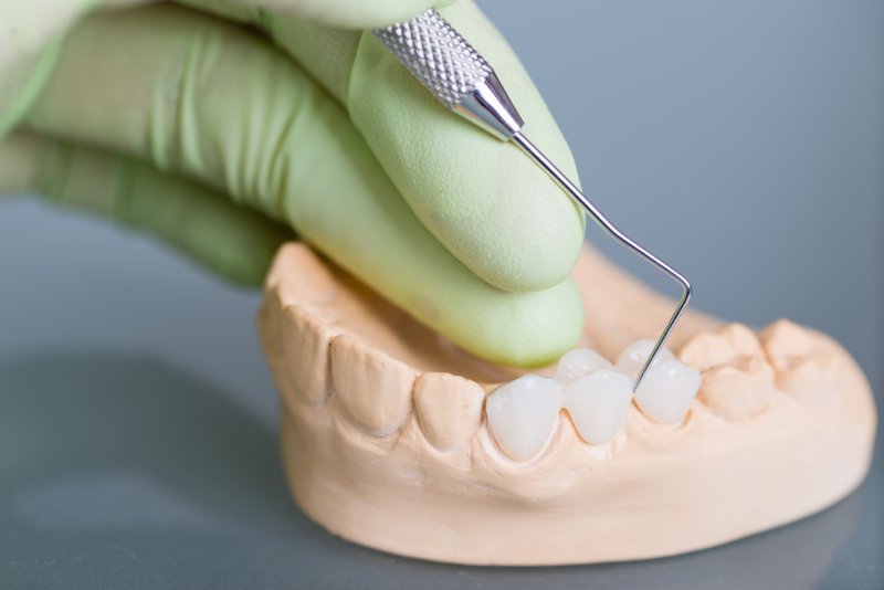 A lab worker modifying a dental bridge